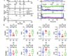 Research Progress in Nonlinear Analysis of Electroencephalogram Variability as a Measure of the Depth of Anesthesia was Reported by IEEE TIM